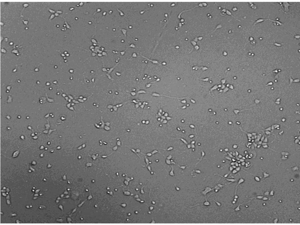 Primary - Rat Cerebral Cortex Neurons - Viability 64 per cent